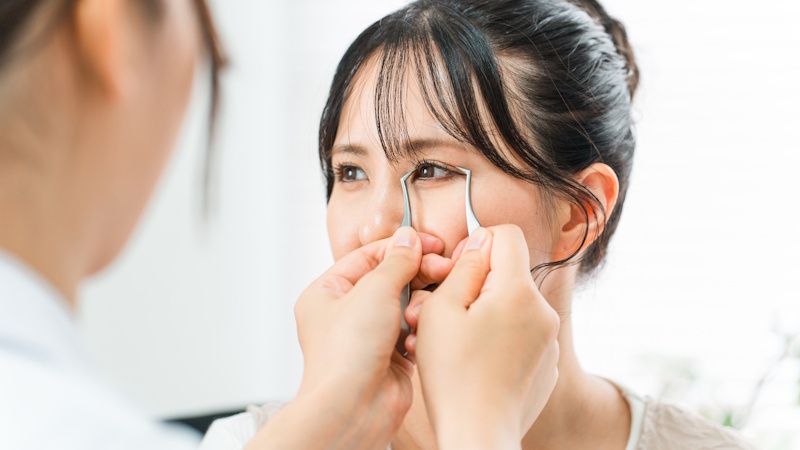 美容クリニックの広告規制とは?NG表現や言い換え方法を紹介 サムネイル画像